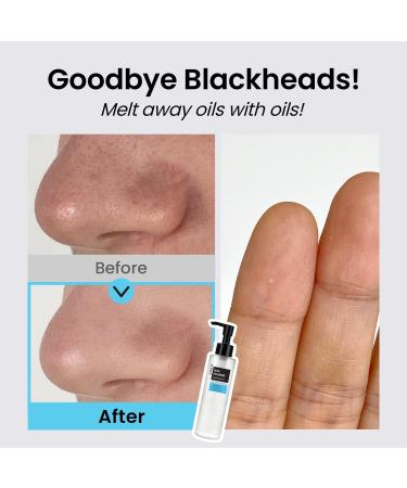  Coxir Ultra Hyaluronic Cleansing Oil 150ml (5.07 fl.oz.) | Deep Cleaning and Hydration | Cruelty Free No Mineral Oil - Buy Online on GoSupps.com