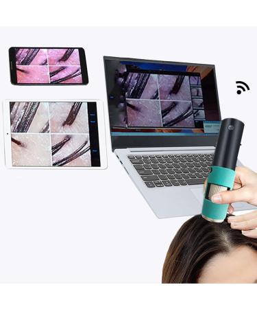 Skin Hair Detector 3MP Wireless Scalp Detector Accurate for Clients for Beauty Salons - Buy Online on GoSupps.com