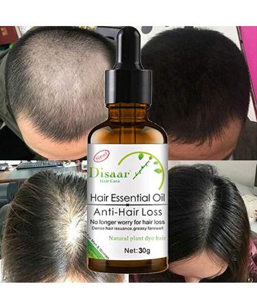 DISAAR BEAUTY Hair Growth Essential Oil 30g - Natural Plant Dry Growth Essence for Anti Hair Loss and Scalp Treatments with Genseng for Dense Hair - Buy Online on GoSupps.com
