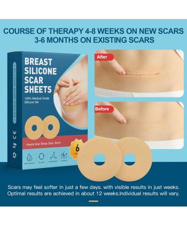 Silicone Scar Sheets for Breast - 6 Pack, Post-Surgery Supplies for Scar Treatment - Buy Online on GoSupps.com