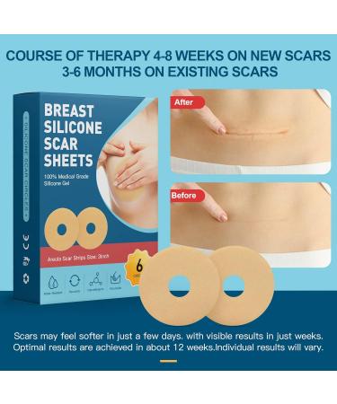 6 Pack Silicone Scar Removal Sheets for Breast - Effective Post-Surgery Scar Treatment for Breast Augmentation & Reduction - Blue Silicone Tape - Buy Online on GoSupps.com