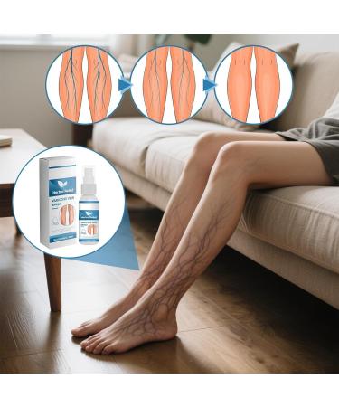Calf Spray Veins Promoted Blood Circulation Nebulizer 30mlPortable Natural Soothing Vein Protection for Men Women Adults - Buy Online on GoSupps.com