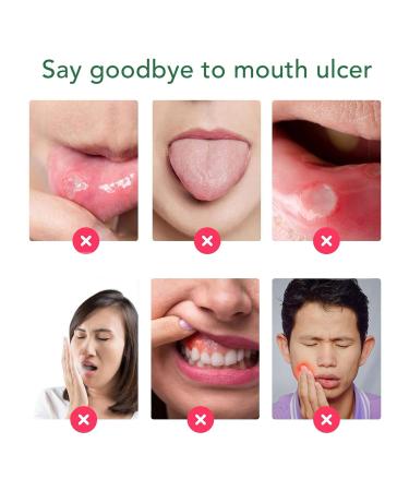 Herbal Oral Spray for Pain Relief | Natural Daily Care | 40ml Soothing Treatment - Buy Online on GoSupps.com