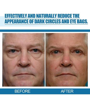  Zankie Eye Contour Cream for Men Moisturizing Essence Eye Cream 0.5 oz | Moisturizing Essence and Eye Skin Care to Avoid Dull Eye Area Zankie - Buy Online on GoSupps.com