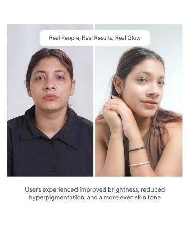 Cos-IQ 23% Vitamin C Face Serum for Glowing Skin 30ml| Advanced Molecular Skincare Technology | Highly Stable Non Irritating Non Sticky| Brightening & Hydrating Formula For Men & Women - Buy Online on GoSupps.com