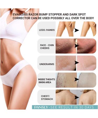 Tend Skin Ingrown Hair Solution - After Shave Treatment for Reducing Redness and Dark Spots - Buy Online on GoSupps.com