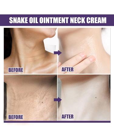 Neck Moisturizer Cream - Firming & Tightening Roll-On for Wrinkle Removal & Deep Nourishment | Effective Skincare Solution - Buy Online on GoSupps.com