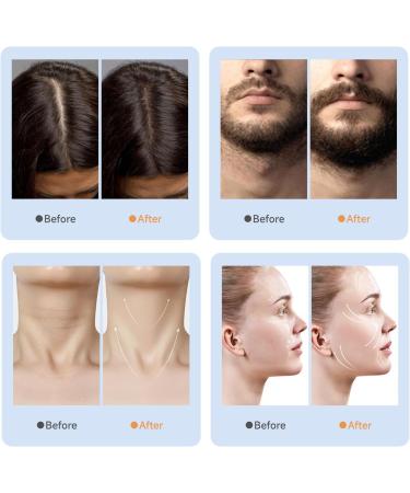 Yofuly Derma Roller Electric EMS Beard Roller with 2 LED Light Professional Beard Dermaroller for Body & Face Skin Care - Buy Online on GoSupps.com