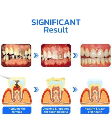 Propolis Oral Instant Treatment Spray Propolis Oral Health Spray Propolis Oral Spray Fresh Breath 0.34Fl Oz (1Pcs) - Buy Online on GoSupps.com