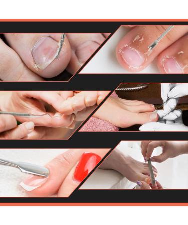 BEZOX Ingrown Toenail Removal Kit - Stainless Steel Tools for Pedicure - 6 PCS Set - Buy Online on GoSupps.com