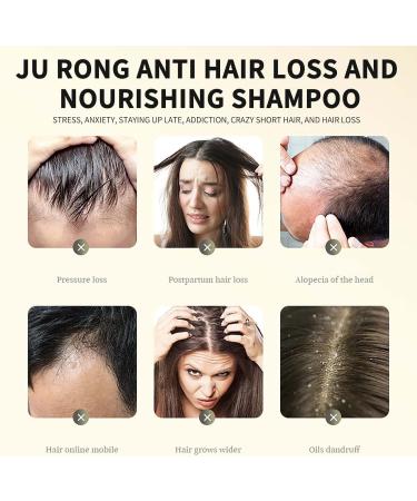 Ginger Plant Extract Anti-Hair Loss Hair Shampoo Ginger Shampoo for Hair Growth Ginger Plant Extract Anti-Hair Loss Hair Shampoo Anti-Hair Loss and Hair Strengthening Shampoo (1 Piece) 1 pc - Buy Online on GoSupps.com