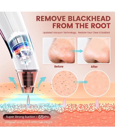2023 Newest Blackhead Remover Pore Vacuum - Rechargeable Pore Cleanser for Men and Women - LED Screen, 4 Probes, 3 Modes - At-Home Facial Beauty Device - Buy Online on GoSupps.com