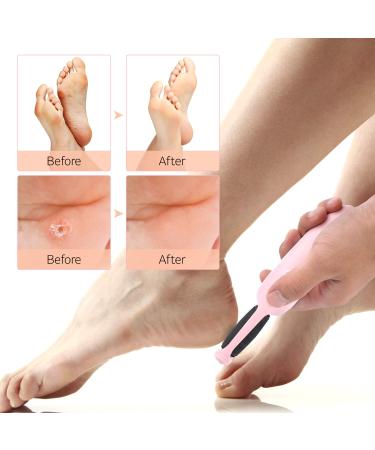 ABKO Rechargeable Electric Callus Remover - Cordless Foot File for Dead Skin and Cracked Heels - Adjustable Power Pedi Feet Care - Easy Grip - CR01 Pink - Buy Online on GoSupps.com