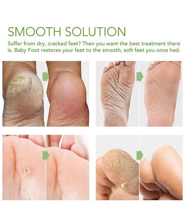 Foot Peel Mask - Exfoliating Baby Soft Skin Treatment for Men & Women | Lavender Scent - 2 Pairs - Buy Online on GoSupps.com