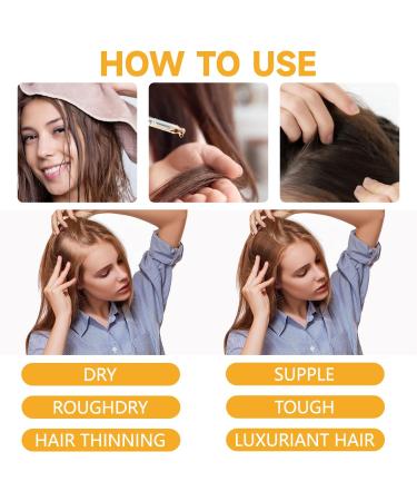  MagiSel Anti Hair Loss Lotion Men Women 30ml Essence for Hair Growth Fast Growth Hair Treatment Hair Growth Serum Anti Hair Loss for Women - Buy Online on GoSupps.com