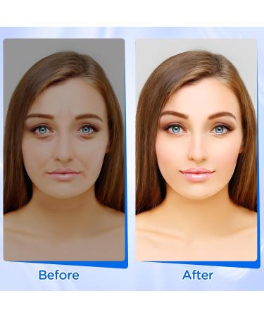 PAFUWEI Forehead Wrinkle Patches - 160 Pieces Anti-Wrinkle Patches for Fine Lines & Wrinkles | Overnight Facial Treatment for Men & Women - Buy Online on GoSupps.com