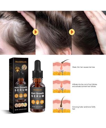 West&Month Allurium Hair Growth Serum for Black Women - Anti Hair Loss, Nourish & Repair - Fast Natural Growth - 3pcs - Buy Online on GoSupps.com