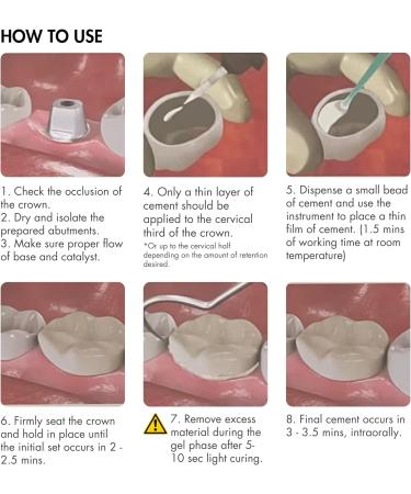 Self-Adhesive Permanent Dental Cement Kit for Caps Crowns & Bridges DIY Repair Solution | International Shipping Available - Buy Online on GoSupps.com