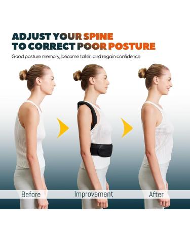 Posture Corrector for Men & Women | Adjustable Back Brace for Pain Relief - Improve Neck & Back Health - Buy Online on GoSupps.com