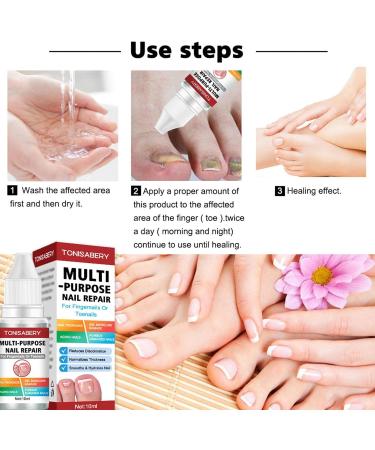 EUBEISAQI Multifunctional nail repair Nail renewal Nighttime Nail 10ml Fungi Fingernail & Toe Nail Solution for broken cracked and discolored nails or fingernails - Buy Online on GoSupps.com