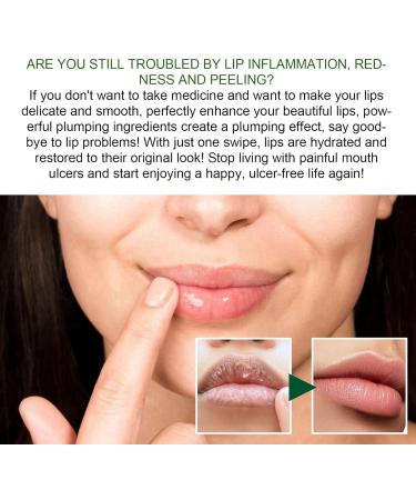 Mouth Ulcer Treatment Spray Mouth Ulcer Treatment for Adults Canker Sore Treatment Oral Care Spray Herbal Mouth Spray Canker Sores Relief Spray for Mouth Ulcer Bad Breath Treatment Mouth Freshener - Buy Online on GoSupps.com