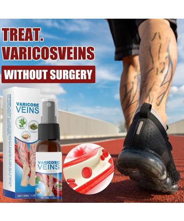 Veinhealing Varicose Veins Treatment Spray - 30 ml (3 Pack) for Effective Relief & Healing | Best Varicose Veins Solution for Legs - Buy Online on GoSupps.com