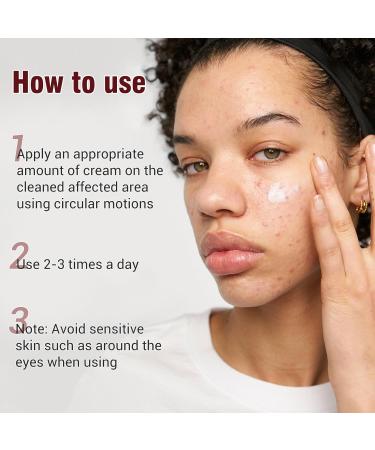Folliculitis Treatment Cream Fast-Acting Relief for Scalp Face & Body Soothes Itching Redness & Inflammation Natural Colloidal Oatmeal Formula for Sensitive Skin - 3.52oz 3.52 Ounce - Buy Online on GoSupps.com