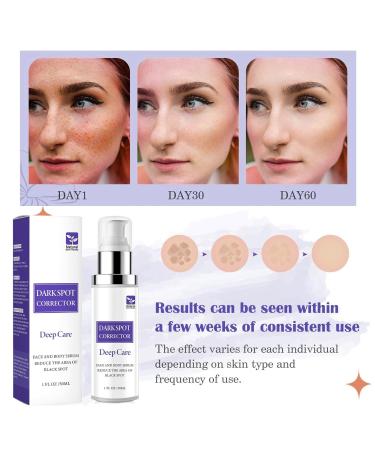 Buy Dark Spot Remover for Face - Faded Serum & Age Spot Corrector - Skin Care Glow Serum for Women - Buy Online on GoSupps.com