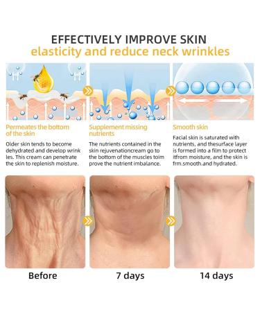 Bee Poison All-in-One Cream New Professional Bee Venom Skin Treatment Cream Repair Moisturize and lift 3 in 1 for All skin Types. (1) - Buy Online on GoSupps.com