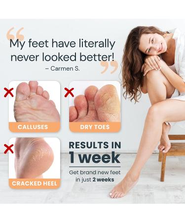 Scala Foot Peel Mask Treatment - 2 Pack Dead Skin Remover & Exfoliator Gel for Soft, Smooth Feet - Buy Online on GoSupps.com