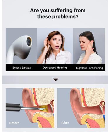 BEBIRD C3 Ear Wax Removal Tool with 1080P HD Otoscope & 6 LED Light | Ear Cleaner & Camera Kit for iOS/Android - Black - Buy Online on GoSupps.com