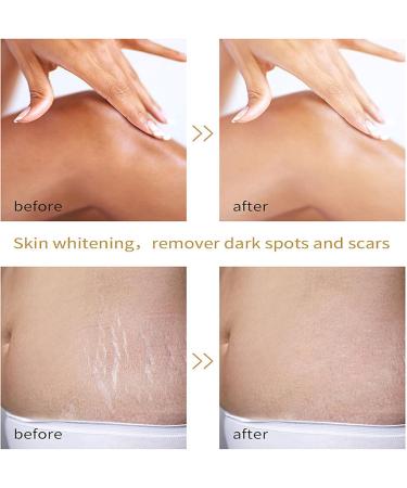 Yellow Peeling Oil - Lightening Exfoliating Dark Skin For Body Strong Peeling Oil Skin Peeling Oil For Skin Lightening Peeling Oil For Skin Brightening Moisturizing Peeling Solution Dark Skin - Buy Online on GoSupps.com