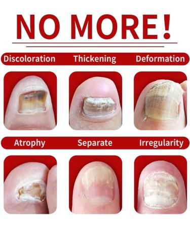 Nail oil for and strength natural plants nail care oil 30 ml strengthening care gel natural repair for home family friendly stressed nails - Buy Online on GoSupps.com