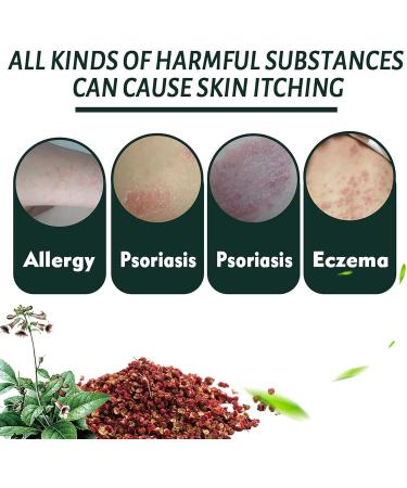 Zdiwond Psoriasis & Eczema Soothing Ointment - Natural Chinese Herbal Healing Cream for Dry Skin (2PCS) - Buy Online on GoSupps.com