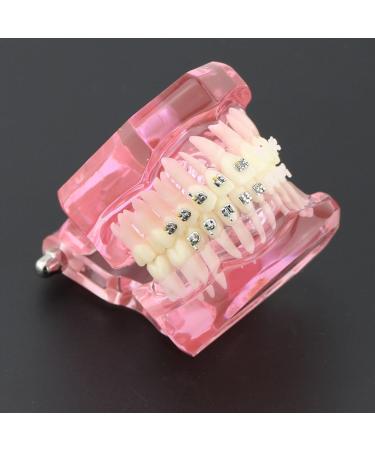 Buy Dental Orthodontic Teeth Model with Metal & Ceramic Brackets - Ideal for Study & Research | International Shipping Available - Buy Online on GoSupps.com