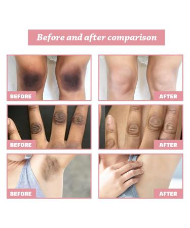 BEROZA 2Pcs Crema Reparadora Para Manchas Oscuras 50ml Vitamin C Body Moisturizer Cream Crema ntima para mujeres Adecuado para varias reas como cara axilas cuello zona privada - Buy Online on GoSupps.com