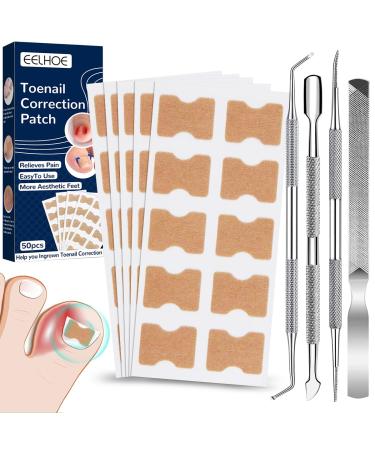 Ingrown toenails tool set 50pcs of ingrown correction stickers pedicure set with 4 toenail correction pedicure tools nail slide nail file for treatment protects toenails ingrown toenail-6