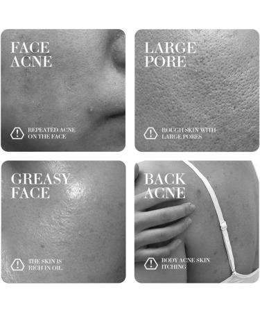 Turmeric Soap Natural Turmeric Soap Bar Pure Turmeric Handmade Soap Bar For Face & Body Dark Spot Corrector Remover Moisturizing Fine Lines Firming Friendly Vegans&Cruelty - Buy Online on GoSupps.com