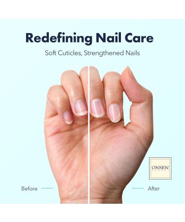 Nail Skin Oil - Onsen 30ml | Japanese Nail Treatment for Damaged Nails | Natural Nail Care & Repair | Visible Results for Perfect Nails - Buy Online on GoSupps.com