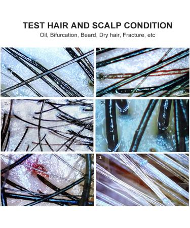7 Inch Skin Diagnosis Hair Analyzer Scalp Hair Follicles Detector with Dual Probes 200x 50x High-Definition Lens with 2 Million Pixels for Imaging for Beauty Salon Hair Salon - Buy Online on GoSupps.com
