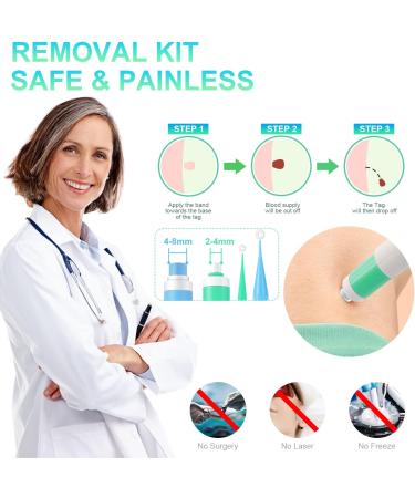 New Version Auto Skin Tag Remover Kit 2-Set Painless Skin Tag Removal Kit Tools for (1-9mm) Skin Tags (includes 100 Removal Bands & 36 Repair Patches & 20 Pcs Cleansing Wipes) Blue Green 2pcs Kit - Buy Online on GoSupps.com