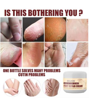 Foot Care Cream for Dry Stressed Feet | Healing & Softening Ointment for Men & Women | Heel Repair - 50g - Buy Online on GoSupps.com