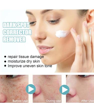 Dark Spot Corrector for Face - 3 Pack Freckle and Discoloration Correcting Serum - Buy Online on GoSupps.com
