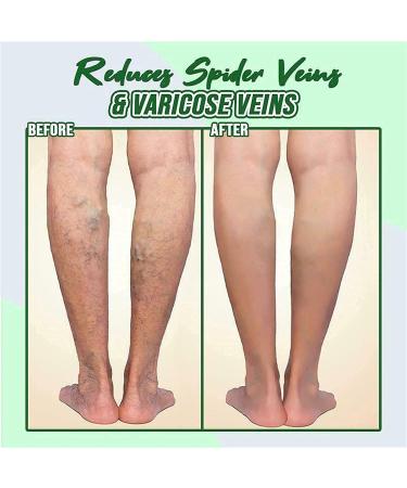 Lymph Draining Artemisia Argyi Massage Oil | Relaxing Body Massage Oil for Blood Circulation (2PC) - Spa Quality Care - Buy Online on GoSupps.com