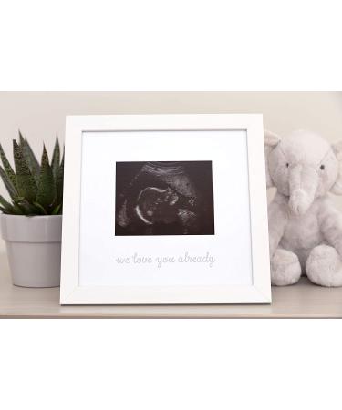 Kate & Milo Love at First Sight Ultrasound Picture Frame - White Keepsake Sonogram Frame for Expecting Parents - Buy Online on GoSupps.com