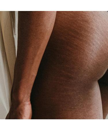 Natural Body Oil for Stretch Marks & Scars - We Are Mamas | Pregnancy & Postnatal Care - 50ml - Buy Online on GoSupps.com