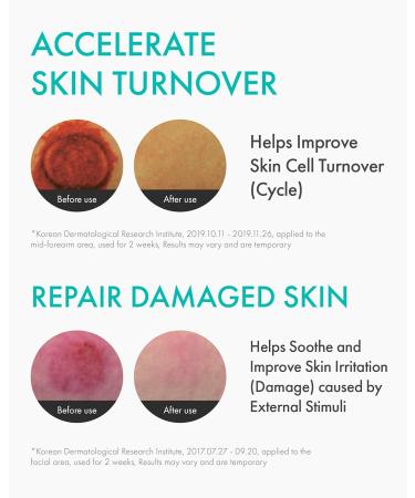 Rejuran Healer Turnover Ampoule - Powerful Anti-Aging Serum with c-PDRN & Hyaluronic Acid for Face & Neck - Buy Online on GoSupps.com