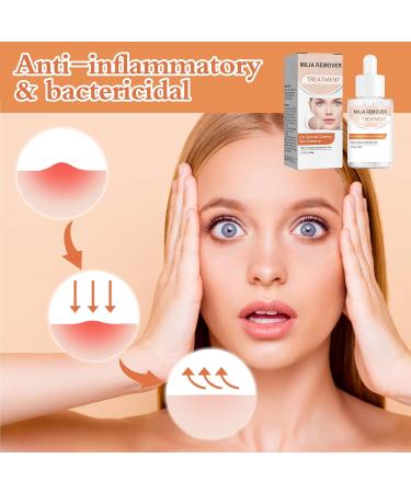 Fat Granule Clearing Skin Essence Milia Clearing Essence Milia Remover Serum Organic Skin Spot Purifying Serum Milia Spot Removal Treatment Helps Dissolve and Reduce Milia - Buy Online on GoSupps.com