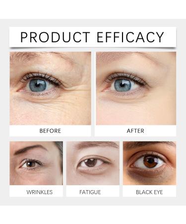 Peptide Eye Cream Anti Wrinkle Eye Cream For Dark Circles & Puffy Eyes With Peptides Eye Bags Remover Tightening Eye Cream Brightening Eye Cream Reduces Crow's Feet Fine Lines & Sagginess - Buy Online on GoSupps.com