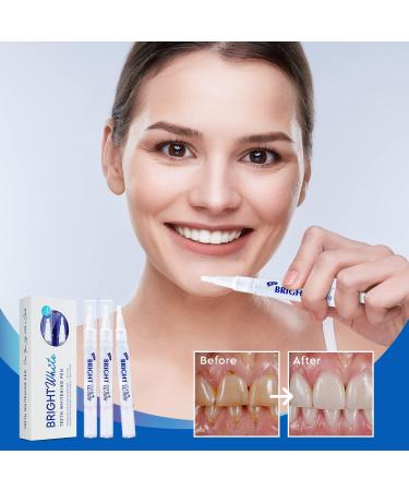 Hermon Premium Teeth Whitening Pen - Pain-Free, Sensitivity-Free, Removes Stains for Whiter Teeth - Buy Online on GoSupps.com